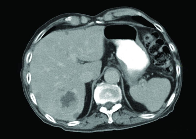 A cross section of a brain CT scan.