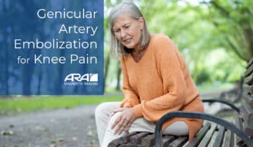 Genicular Artery Embolization for Knee Pain at ARA